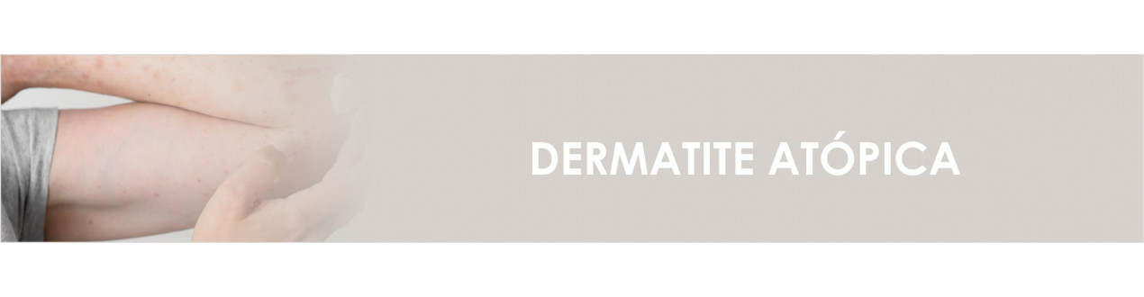 Dermatite Atópica